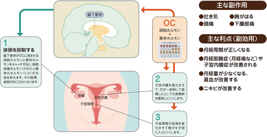 OCの効果